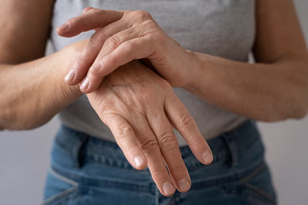 Rheumatoid Arthritis